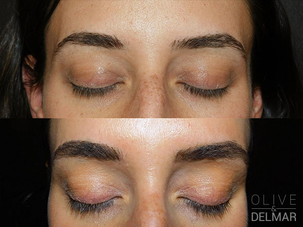 neuLASH PROFESSIONAL™ Before and After image.